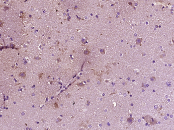 Phospho-Smad1 (Ser465) Rabbit Polyclonal Antibody