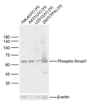 Phospho-Smad1 (Ser465) Rabbit Polyclonal Antibody
