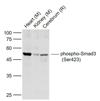 Phospho-Smad3 (Ser423) Rabbit Polyclonal Antibody