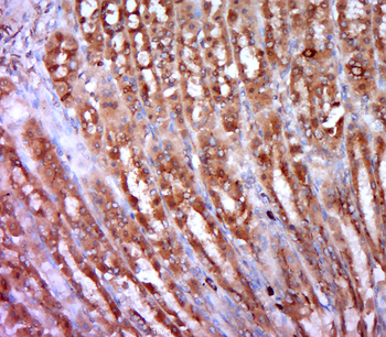 Smoothelin Rabbit Polyclonal Antibody
