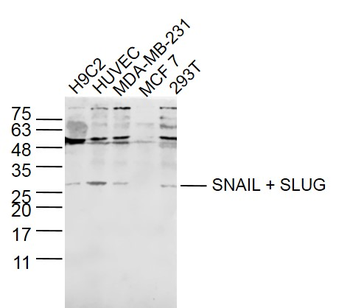 SNAIL + SLUG Rabbit Polyclonal Antibody