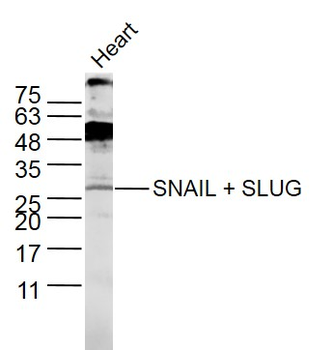 SNAIL + SLUG Rabbit Polyclonal Antibody