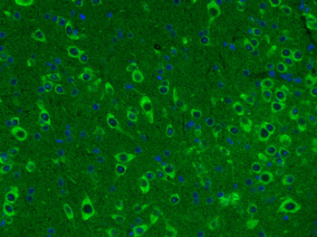 Somatostatin 28 Rabbit Polyclonal Antibody