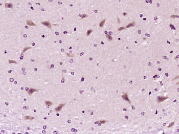 Somatostatin 28 Rabbit Polyclonal Antibody