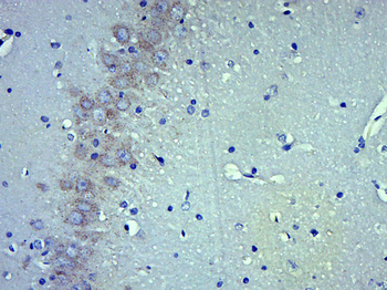Somatostatin 28 Rabbit Polyclonal Antibody