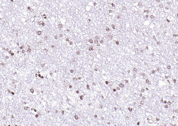 SOX4 Rabbit Polyclonal Antibody