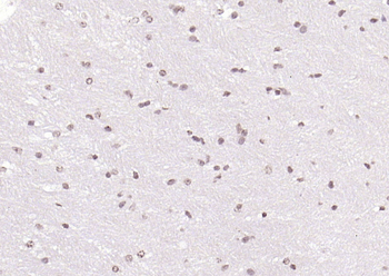 SOX4 Rabbit Polyclonal Antibody