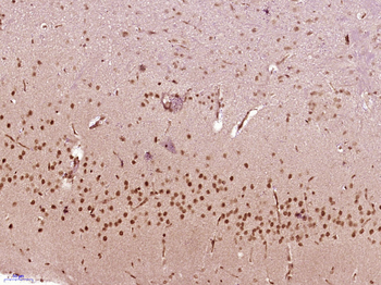 SOX4 Rabbit Polyclonal Antibody