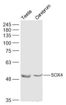 SOX4 Rabbit Polyclonal Antibody