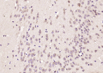 SPG3A Rabbit Polyclonal Antibody