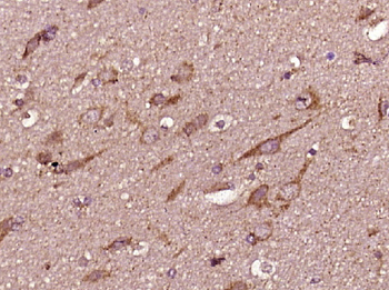 SPG48 Rabbit Polyclonal Antibody