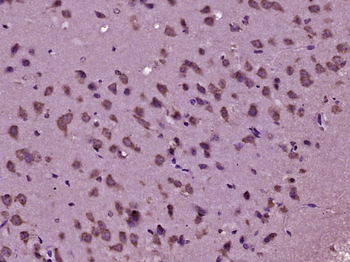 Neurabin 2 Rabbit Polyclonal Antibody