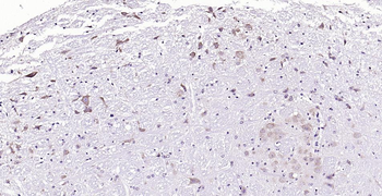 Neurabin 2 Rabbit Polyclonal Antibody