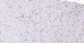 Neurabin 2 Rabbit Polyclonal Antibody