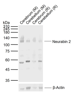 Neurabin 2 Rabbit Polyclonal Antibody