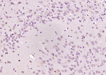 SPOCK2 Rabbit Polyclonal Antibody