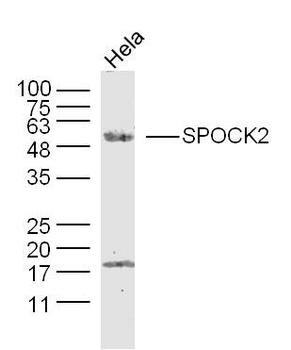 SPOCK2 Rabbit Polyclonal Antibody