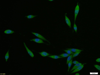 SPR Rabbit Polyclonal Antibody