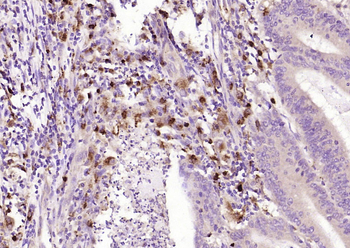 SPR Rabbit Polyclonal Antibody