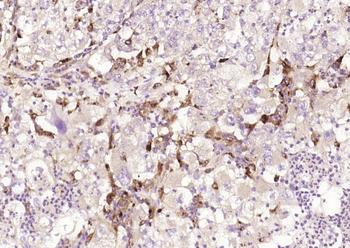 SPR Rabbit Polyclonal Antibody