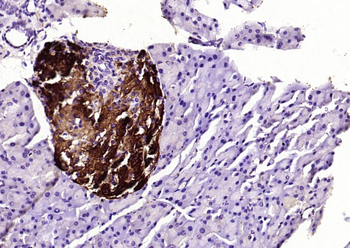 SPR Rabbit Polyclonal Antibody