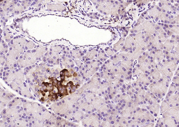 SPR Rabbit Polyclonal Antibody