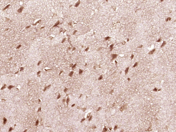 STAT1 Rabbit Polyclonal Antibody