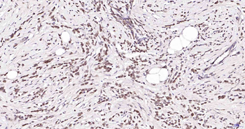 Sumo2 Rabbit Polyclonal Antibody