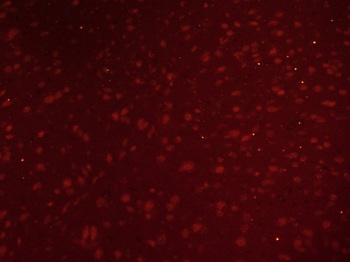 GLI1 Rabbit Polyclonal Antibody (BF555)