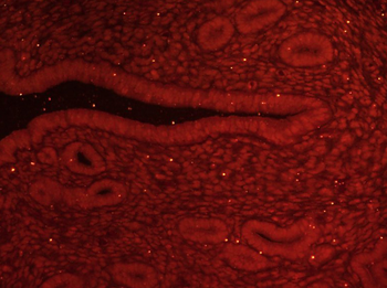 GLI1 Rabbit Polyclonal Antibody (BF555)