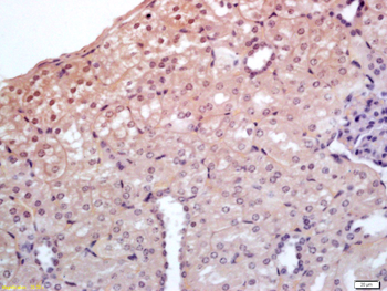 SYF2 Rabbit Polyclonal Antibody