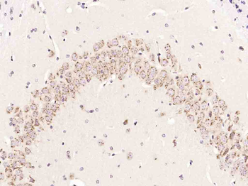 Synapsin III Rabbit Polyclonal Antibody