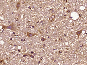 Synaptogyrin 2 Rabbit Polyclonal Antibody