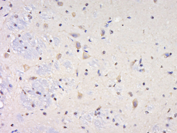 SYNPR/Synaptoporin Rabbit Polyclonal Antibody