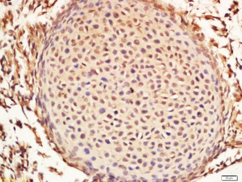 Syntenin 1 Rabbit Polyclonal Antibody