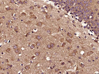 Phospho-Tau (Ser579) Rabbit Polyclonal Antibody