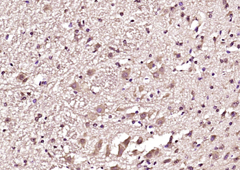 Phospho-Tau (Thr548) Rabbit Polyclonal Antibody