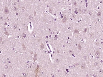 Phospho-Tau (Thr522) Rabbit Polyclonal Antibody