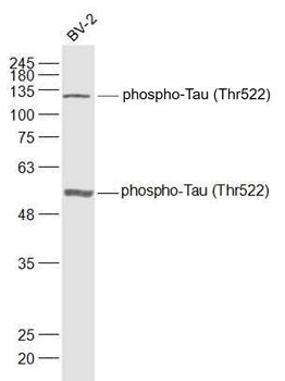 Phospho-Tau (Thr522) Rabbit Polyclonal Antibody