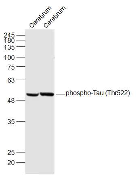 Phospho-Tau (Thr522) Rabbit Polyclonal Antibody