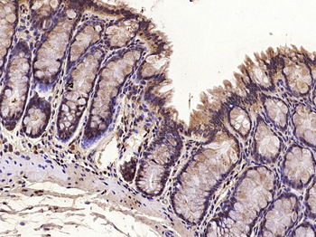 TCF12 Rabbit Polyclonal Antibody