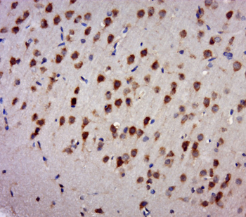 TDRD3 Rabbit Polyclonal Antibody