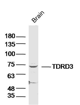 TDRD3 Rabbit Polyclonal Antibody