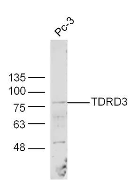 TDRD3 Rabbit Polyclonal Antibody