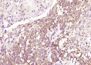 TEM8 Rabbit Polyclonal Antibody