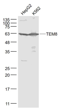 TEM8 Rabbit Polyclonal Antibody