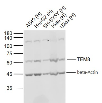 TEM8 Rabbit Polyclonal Antibody
