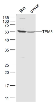 TEM8 Rabbit Polyclonal Antibody