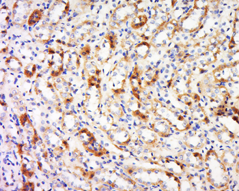 Transglutaminase 6 Rabbit Polyclonal Antibody