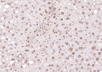 THRB1 Rabbit Polyclonal Antibody